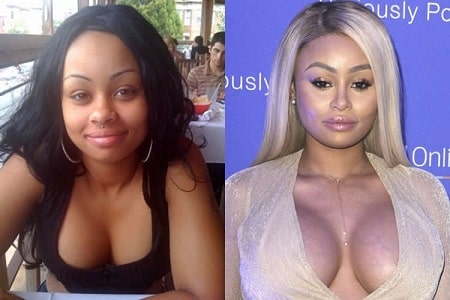 A picture of Blac Chyna before (left) first surgery and after (fourth) surgery.